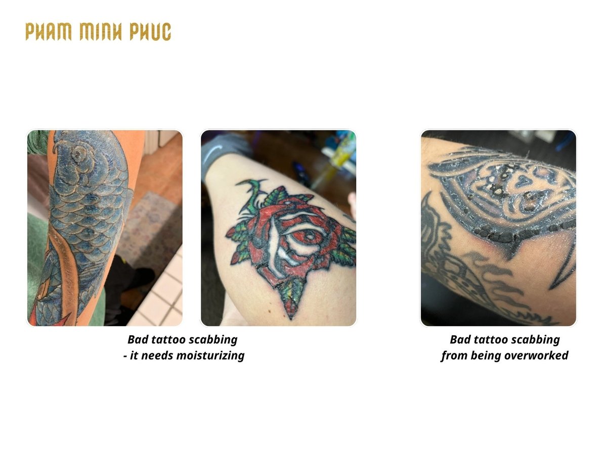 Bad tattoo scabbing