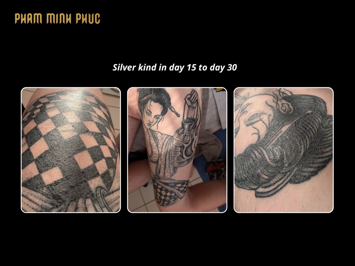 surface healing runs from around day 15 to day 30