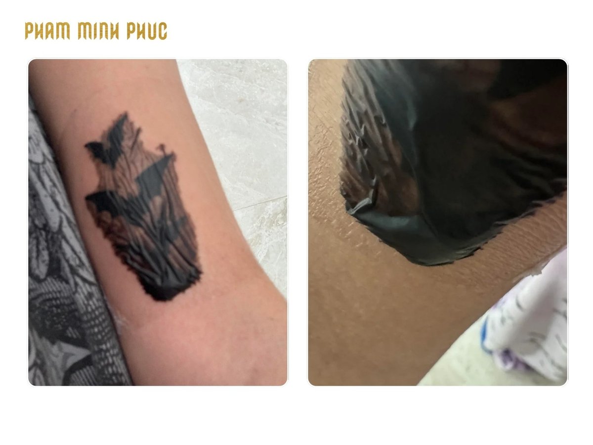 Tattoo leaking ink example