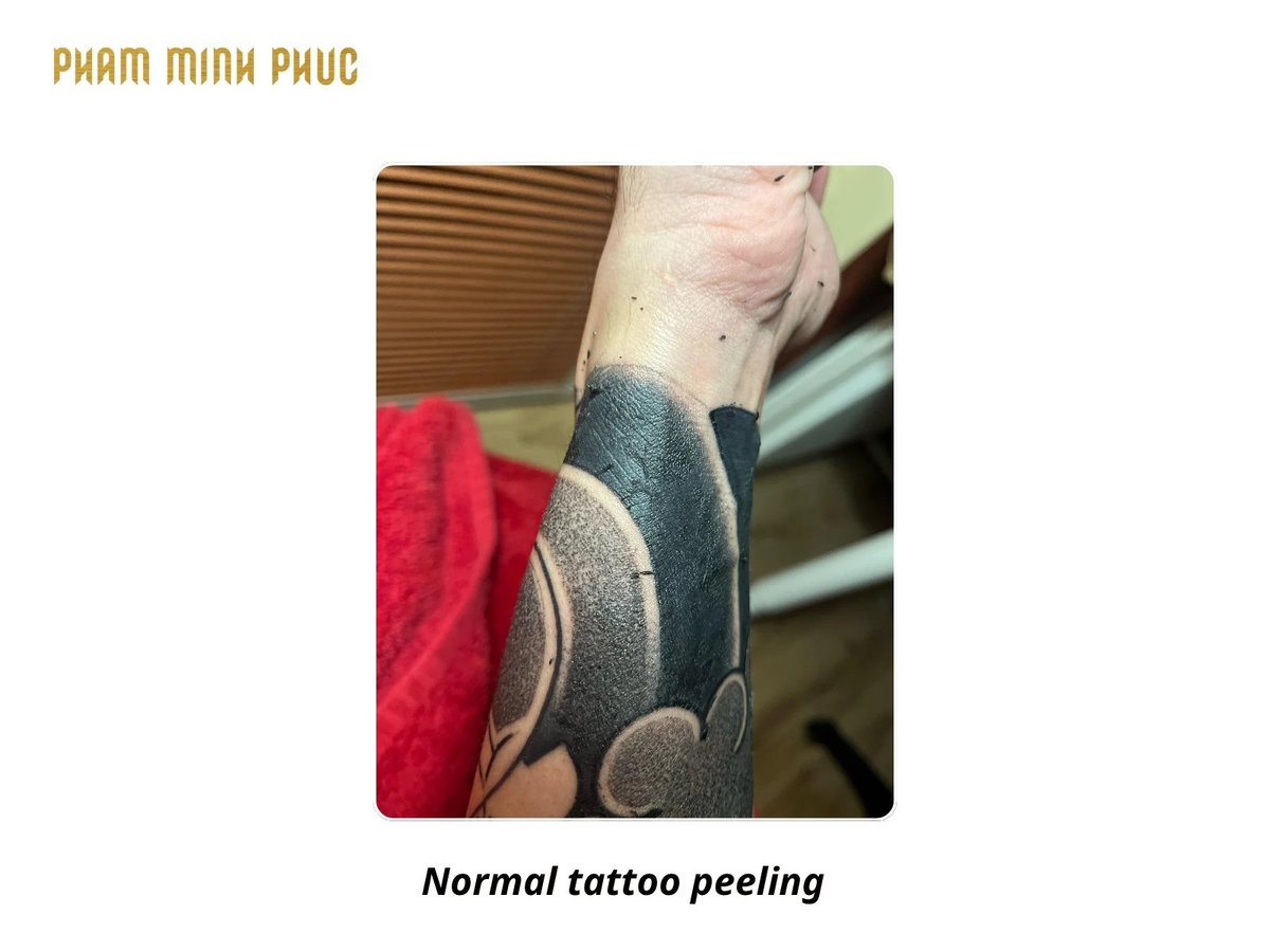 normal tattoo peeling
