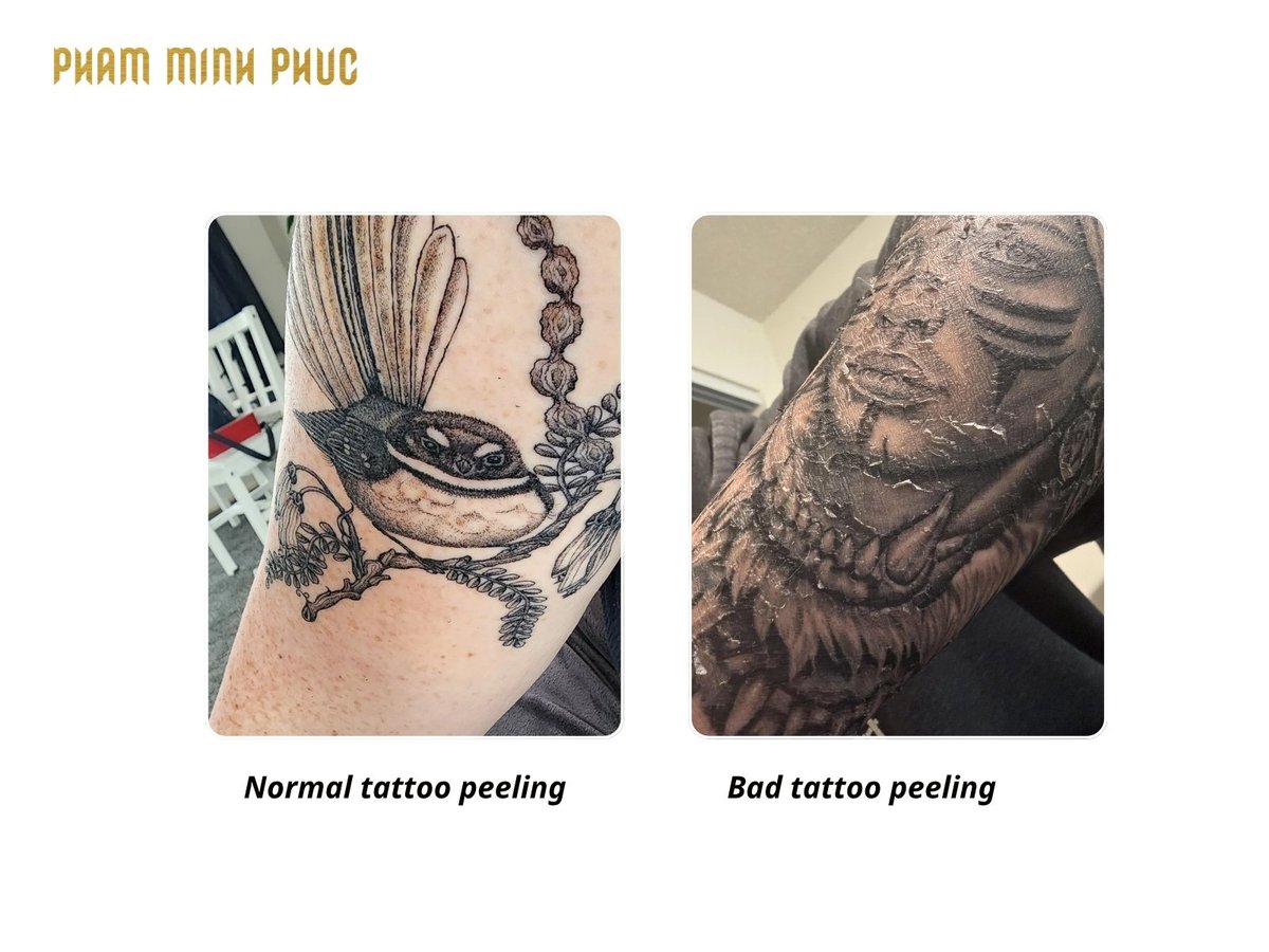 difference of normal and bad tattoo peeling