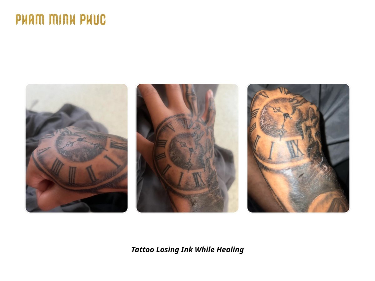 Hand tattoo losing ink while healing