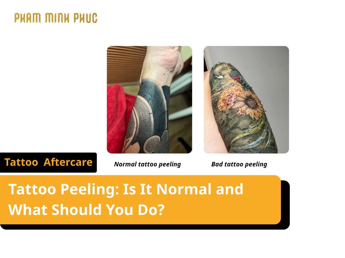 Tattoo Peeling in Healing Time