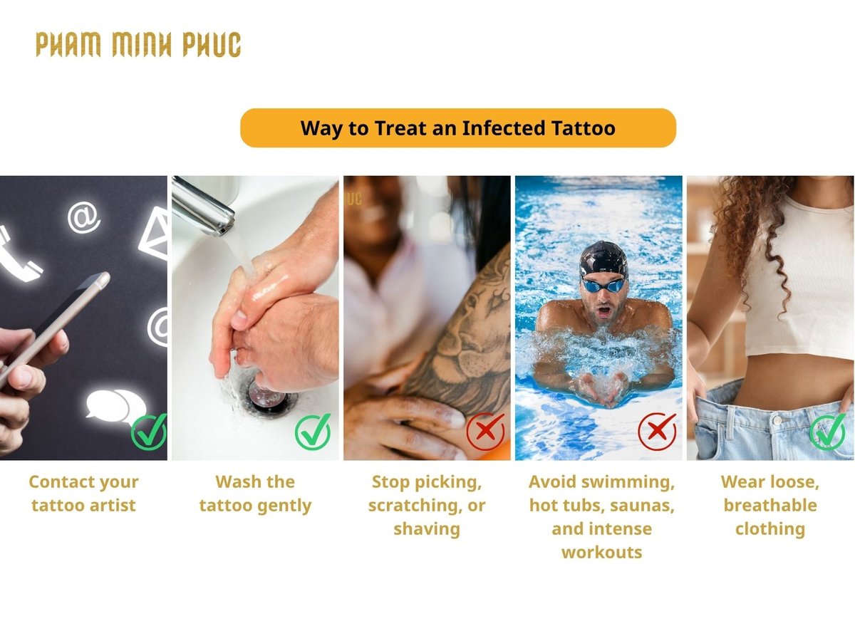 way to treat infected tattoo when waiting to be evaluated